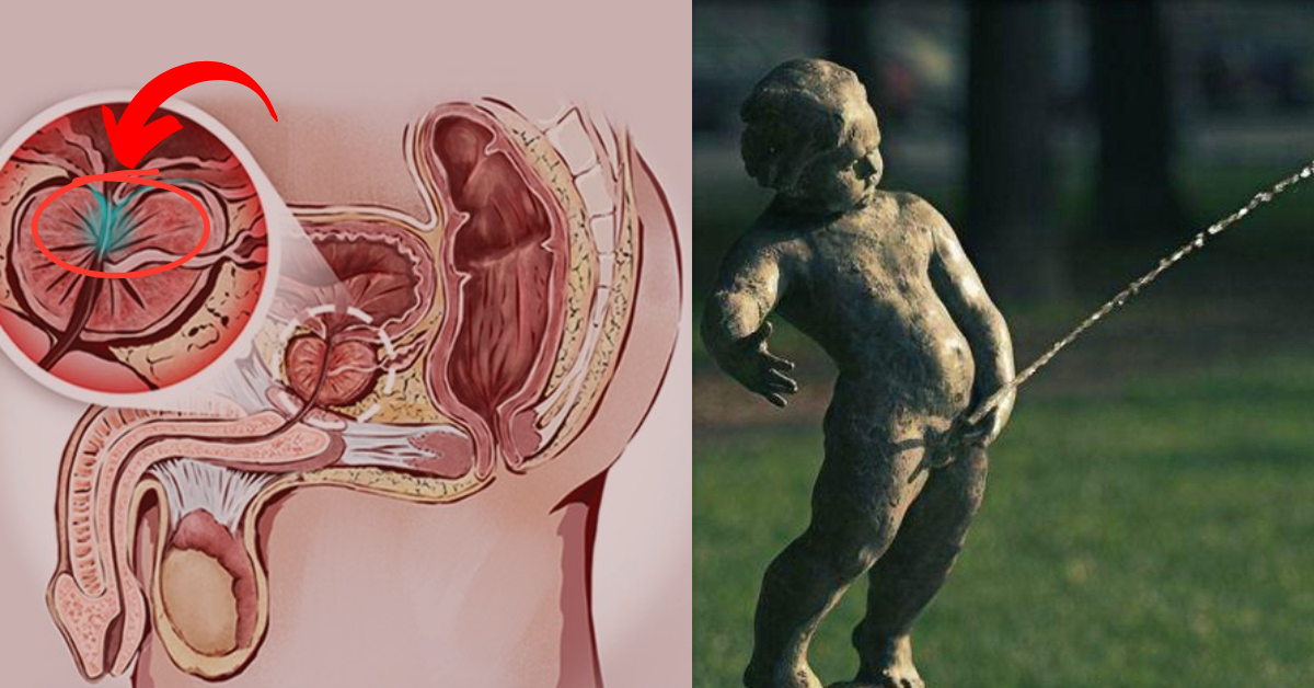 enlarged prostate main img